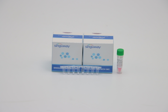 실험실 POCT IVD 결핵 마이코박테륨 TB PCR 탐지는 ISO9001을 시험하는 DNA를 장비를 답니다