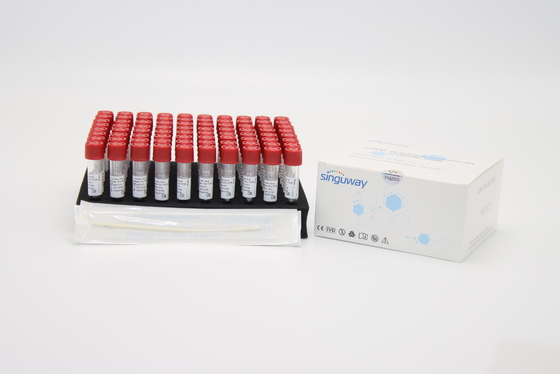 CE 바이러스성 핵산 차단은 바이러스의 RNA DNA 추출 키트 1mL/ 튜브를 장비를 답니다