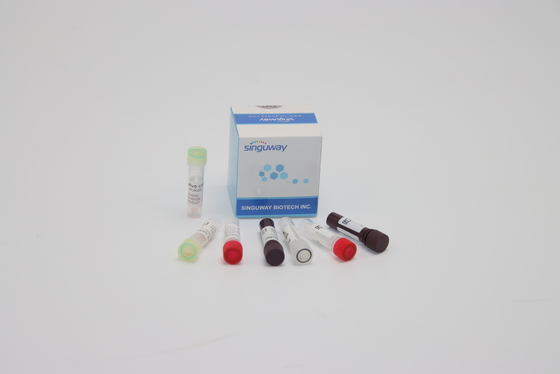 ORF1ab HPV PCR 검출은 임상적 진단을 위한 핵산 유전적 테스팅을 장비를 답니다