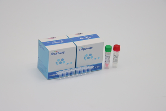 HIV 바이러스 양적 휘황한 PCR 탐지는 POCT 실시간 CE를 장비를 답니다