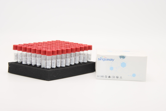 시구웨이 PCR 검사 독감 바이러스 견본 방출 시약 RNA 추출 키트